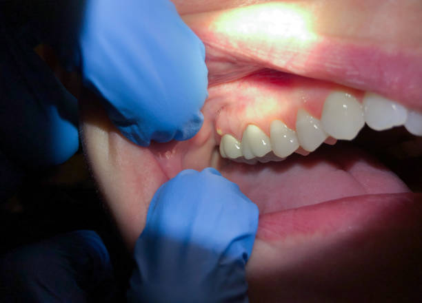 Best Chipped Tooth Repair Near Me  in Fair Plain, MI