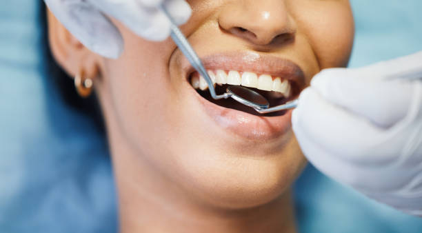 Best Root Canal Emergency Dentist  in Fair Plain, MI